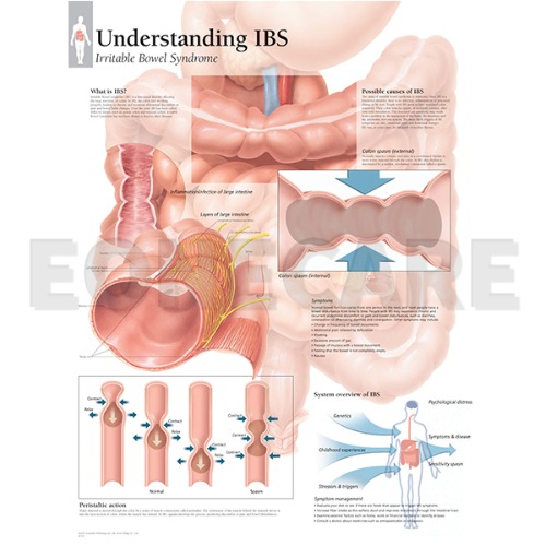 평면해부도(벽걸이)/ 1551 /과민성대장증후군/Understanding IBS /사이즈   56cm ⅹ 71cm Paper