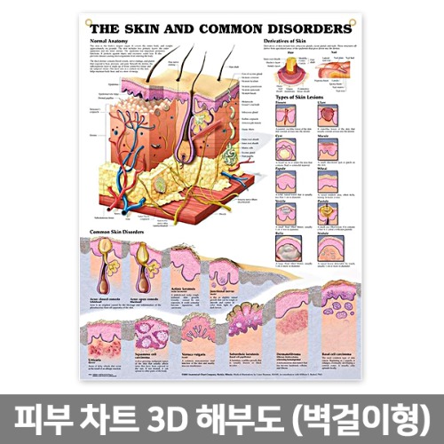 3D해부도(벽걸이) / 9940B / 피부차트 (THE SKIN AND COMMON DISORDERS )