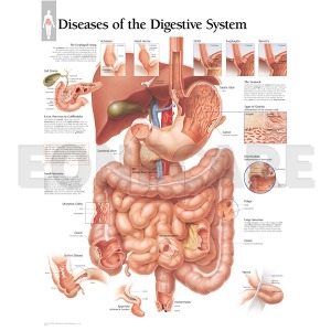 평면해부도(벽걸이) /소화기관의 질병/ 1552 Diseases of the Digestive System / 사이즈   56cm ⅹ 71cm Paper