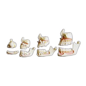 실제크기 치아발달모형 4단계 (EBK3-316) 영아, 유아, 어린이,성인 치아와 상하턱구조 모형 인체모형