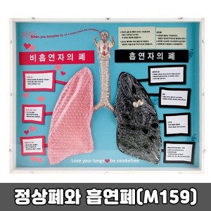[SY] 정상폐와 흡연폐 (폐비교모형) M159 금연교육 흡연예방 보건교육