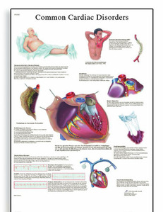 [독일3B] 심장질환차트 Common Cardiac Disorders Chart VR1343L(코팅) 인체해부도