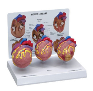 [GPI] G255 심장질환3가지모형  /3-pc Mini Heart Set Models 255