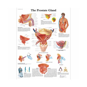 [독일3B] 전립선차트 The Prostate Gland Chart VR1528L(코팅) 인체해부도