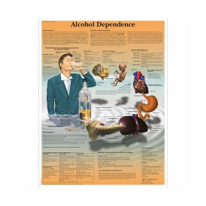 [독일3B] 알코올 중독차트 Drug Dependence Chart VR1792L(코팅) 인체해부도